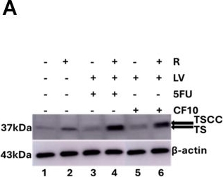 Fig.3.A showing Western Blotting from the publication: CF10/LV overcomes acquired resistance to 5-FU/LV in colorectal cancer cells through downregulation of the c-Myc/ABCB5 axis.