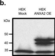 Fig.2.B showing Western Blotting in a Homo sapiens (Human) sample from the publication: Identification of the Annexin A2-interacting domain of pneumococcal PsaA.