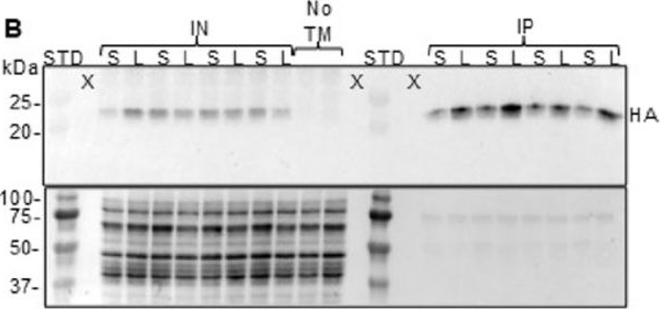 Fig.2.B showing Western Blotting in a Mus musculus (House mouse) sample from the publication: Co-translational profiling in the cardiac endothelium in response to LPS-induced inflammation in female mice in vivo: a proof-of-concept approach.