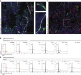 Fig.1.F showing Flow cytometry/Cell sorting in a Mus musculus (House mouse) sample from the publication: Bone marrow sinusoidal endothelium controls terminal erythroid differentiation and reticulocyte maturation.