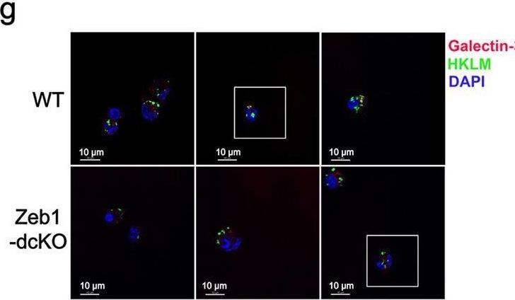 Fig.6.G showing Immunocytochemistry-immunofluorescence from the publication: The transcription factor Zeb1 controls homeostasis and function of type 1 conventional dendritic cells.