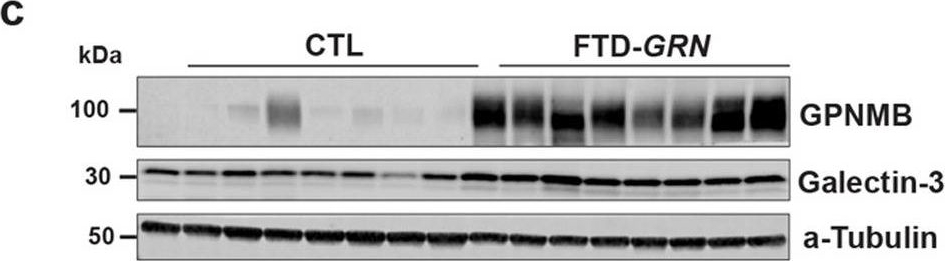 Fig.7.C showing Western Blotting in a Homo sapiens (Human) sample from the publication: Network analysis of the progranulin-deficient mouse brain proteome reveals pathogenic mechanisms shared in human frontotemporal dementia caused by GRN mutations.