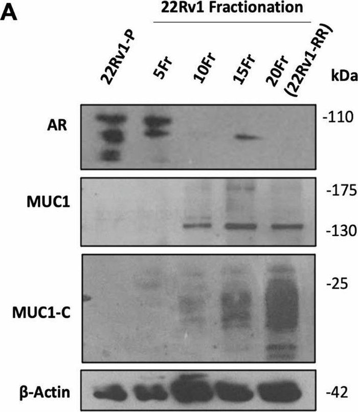 Fig.2.A showing Western Blotting in a Homo sapiens (Human) sample from the publication: Decoding MUC1 and AR axis in a radiation-induced neuroendocrine prostate cancer cell-subpopulation unveils novel therapeutic targets.