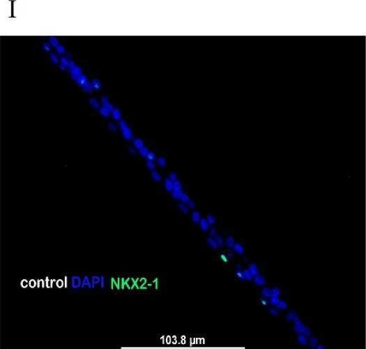 Fig.3.I showing Immunohistochemistry-immunofluorescence from the publication: Mechanical stretch promotes apoptosis and impedes ciliogenesis of primary human airway basal stem cells.