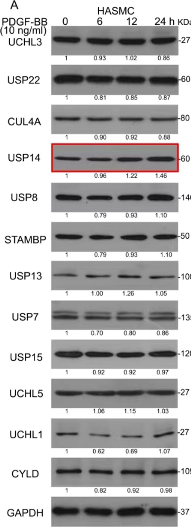 Fig.1.A showing Western Blotting from the publication: USP14 deficiency inhibits neointima formation following vascular injury via degradation of Skp2 protein.
