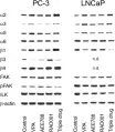 Fig.6.A showing Western Blotting in a Homo sapiens (Human) sample from the publication: Molecular targeting of prostate cancer cells by a triple drug combination down-regulates integrin driven adhesion processes, delays cell cycle progression and interferes with the cdk-cyclin axis.