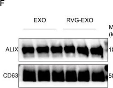 Fig.1.F showing Western Blotting from the publication: Therapeutic potential and underlying mechanisms of engineered young plasma-derived exosomes in Alzheimer's disease.