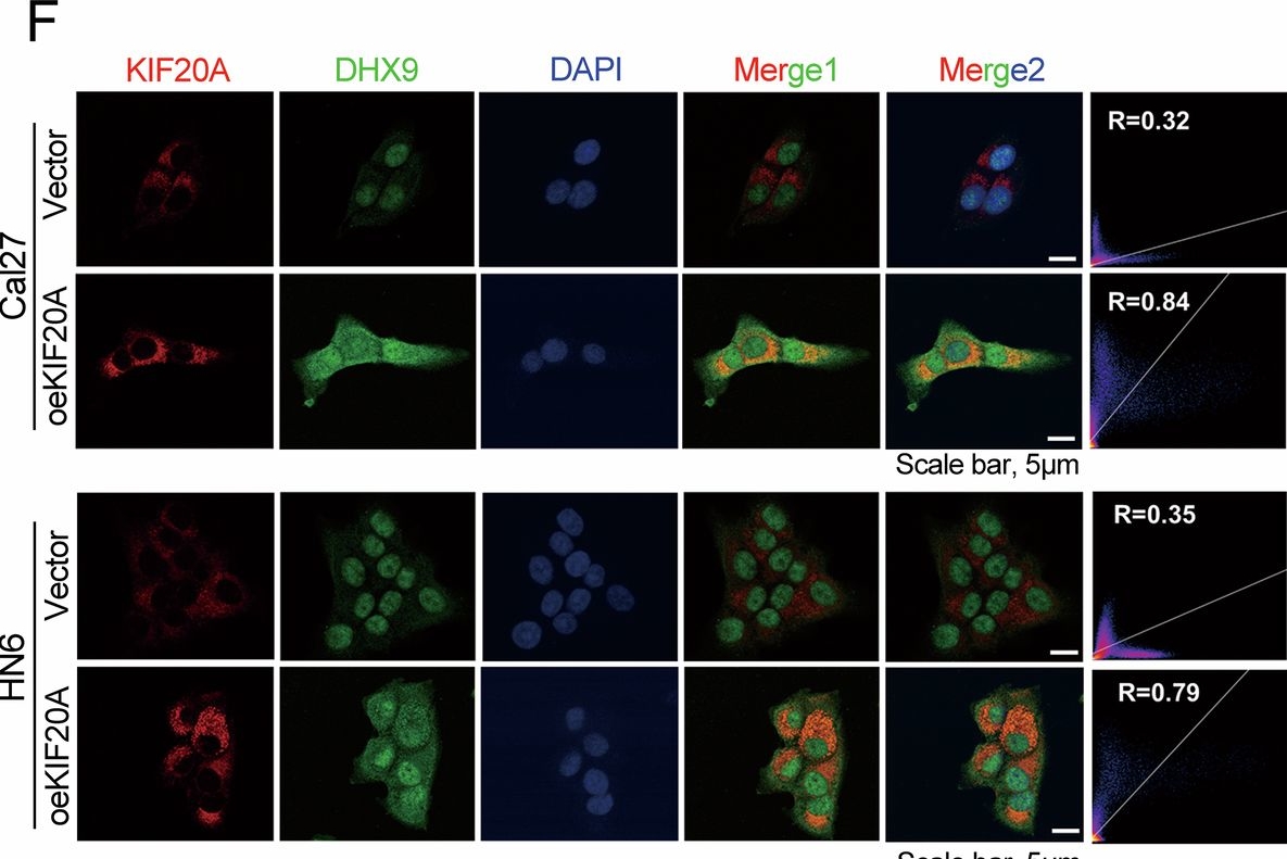Fig.2.F showing Immunocytochemistry-immunofluorescence from the publication: KIF20A inhibits TRIM21-dependent ubiquitination of DHX9 to boost SOX2 stability, enhancing OSCC stemness and ferroptosis resistance.