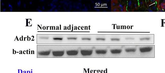 Fig.1.E showing Western Blotting in a Homo sapiens (Human) sample from the publication: Sympathetic signaling facilitates progression of neuroendocrine prostate cancer.