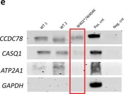 Fig.5.E showing Western Blotting in a Homo sapiens (Human) sample from the publication: CCDC78: Unveiling the Function of a Novel Gene Associated with Hereditary Myopathy.