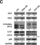 Fig.2.C showing Western Blotting in a Homo sapiens (Human) sample from the publication: Blockage of O-linked GlcNAcylation induces AMPK-dependent autophagy in bladder cancer cells.