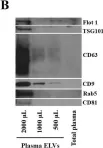 Fig.1.B showing Western Blotting from the publication: Enabling Metabolomics Based Biomarker Discovery Studies Using Molecular Phenotyping of Exosome-Like Vesicles.
