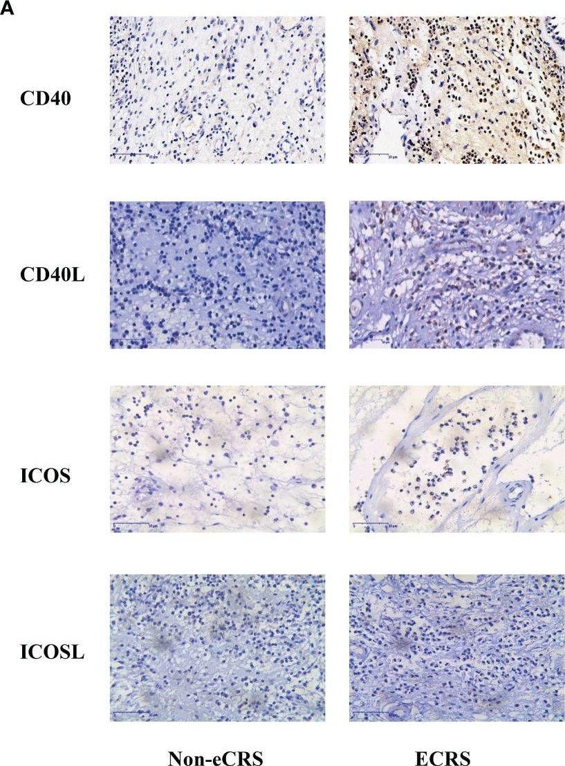 Fig.1.A showing Immunohistochemistry in a Homo sapiens (Human) sample from the publication: Involvement of CD40-CD40L and ICOS-ICOSL in the development of chronic rhinosinusitis by targeting eosinophils.