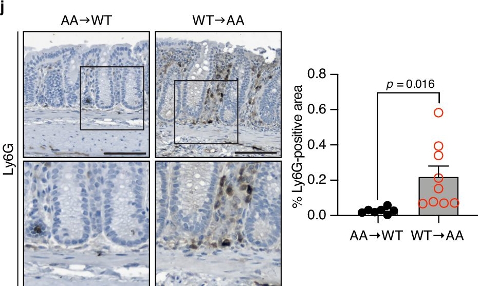 Fig.2.J showing Immunohistochemistry in a Mus musculus (House mouse) sample from the publication: CBP phosphorylation maintains intestinal homeostasis by supporting the stem cell niche through versican.