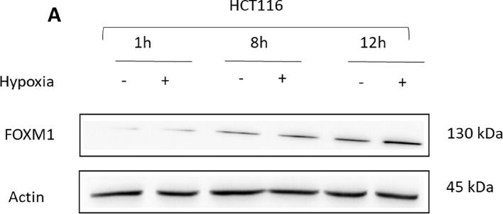 Fig.5.A showing Western Blotting from the publication: FOXM1 expression is induced by the brain microenvironment and supports CRC brain metastatic adaptation.
