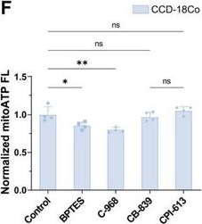 Fig.5.F from the publication: Single-Mitochondrion ATP Profiling Directs Discovery of Targetable OXPHOS Dependency in Cancers.