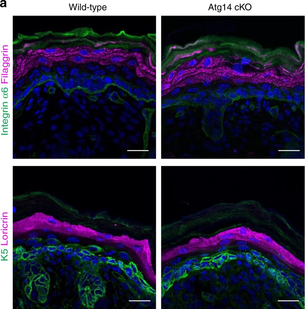 Beclin 1 regulates recycling endosome and is required for skin development in mice.