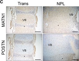 Fig.4.C showing Immunohistochemistry from the publication: Spatiotemporal Characterization of Human Early Intervertebral Disc Formation at Single-Cell Resolution.