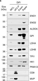 Fig.3.C showing Western Blotting in a Homo sapiens (Human) sample from the publication: Supermeres are functional extracellular nanoparticles replete with disease biomarkers and therapeutic targets.