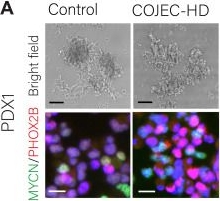 Fig.8.A showing Immunocytochemistry-immunofluorescence from the publication: Clinically relevant treatment of PDX models reveals patterns of neuroblastoma chemoresistance.