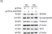 Fig.1.D showing Western Blotting in a Mus musculus (House mouse) sample from the publication: Experimental Validation and Bioinformatics Analysis Elucidate the Role of MTDH-Mediated PTEN Ubiquitination and Degradation in Podocyte Injury in Diabetic Kidney Disease.