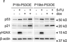 Fig.4.F showing Western Blotting from the publication: Rewiring glucose metabolism improves 5-FU efficacy in p53-deficient/KRASG12D glycolytic colorectal tumors.