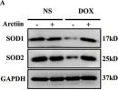 Fig.2.A showing Western Blotting in a Mus musculus (House mouse) sample from the publication: Targeting SIRT1 stability: arctiin ameliorates doxorubicin-induced cardiac injury by inhibiting SMURF2 binding and enhancing protective lipid metabolism.