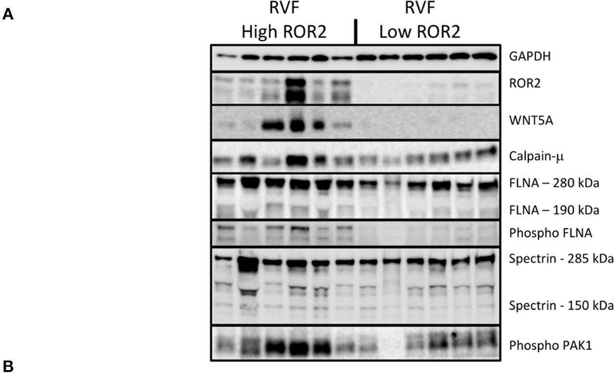Fig.4.A showing Western Blotting in a Homo sapiens (Human) sample from the publication: Noncanonical WNT Activation in Human Right Ventricular Heart Failure.