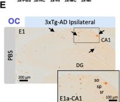 Fig.1.E showing Immunohistochemistry in a Mus musculus (House mouse) sample from the publication: Human and Mouse Alzheimer's Seeds Differentially Affect Amyloid Deposition and Microglia-Dependent Plaque Response in Aged Mice.