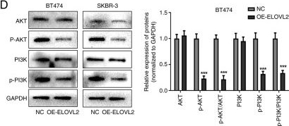 Fig.10.D showing Western Blotting from the publication: Construction of a human epidermal growth factor receptor 2-related gene risk model for predicting breast cancer prognosis.