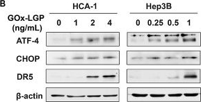 Fig.5.B showing Western Blotting from the publication: Stimuli-Responsive Nanozyme Reprograms Tumor Immunometabolism and Overcomes Therapeutic Resistance in Hepatocellular Carcinoma.