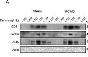 Fig.1.A showing Western Blotting in a Mus musculus (House mouse) sample from the publication: Glycolytic Enzyme HK2 Phosphorylates nSMase1 to Promote Astrocytic Exosomes Biogenesis Contributing to Acute Ischemic Stroke Injury.
