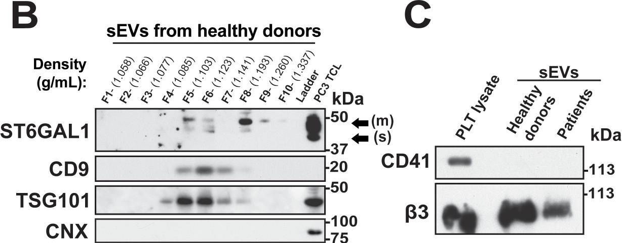 Fig.2.B showing Western Blotting in a Homo sapiens (Human) sample from the publication: A novel sialylation pathway mediated by extracellular vesicles in aggressive prostate cancer.