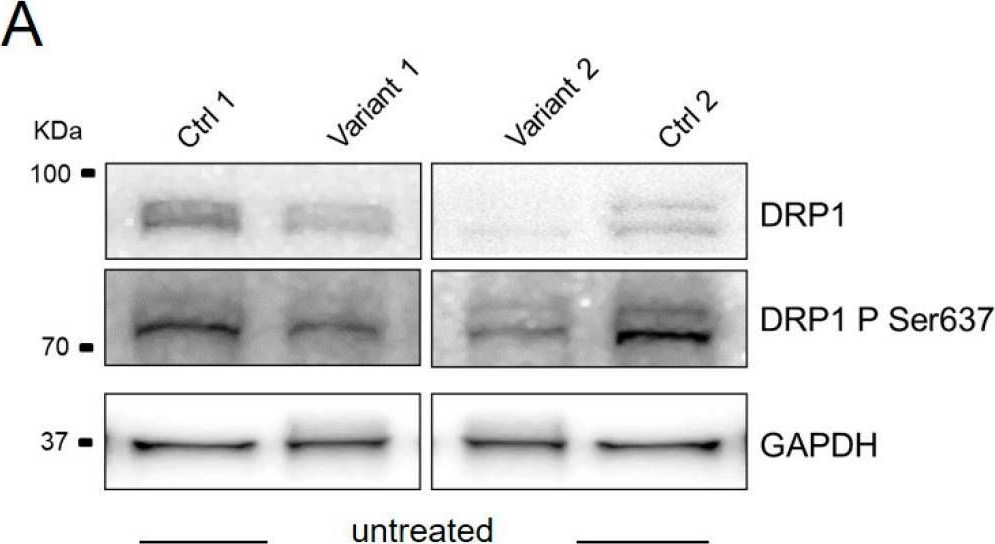 Fig.3.A showing Western Blotting from the publication: Converging Role for REEP1/SPG31 in Oxidative Stress.
