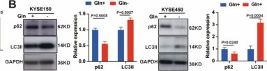 Fig.2.B showing Western Blotting from the publication: Glutamine transporter SLC1A5 inhibits autophagy-mediated CD276 degradation to promote esophageal cancer progression.