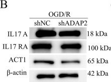 Fig.6.B showing Western Blotting in a Homo sapiens (Human) sample from the publication: Application of acute myocardial infarction-related key genes in noninvasive diagnosis: a comprehensive analysis based on transcriptome and single-cell transcriptome.