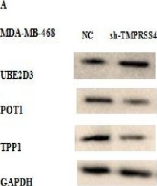 Fig.5.A showing Western Blotting in a Homo sapiens (Human) sample from the publication: Role of TMPRSS4 Modulation in Breast Cancer Cell Proliferation.