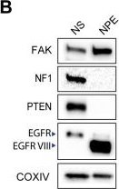 Fig.1.B showing Western Blotting in a Mus musculus (House mouse) sample from the publication: FAK modulates glioblastoma stem cell energetics via regulation of glycolysis and glutamine oxidation.