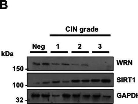 Fig.1.B showing Western Blotting from the publication: Werner Syndrome Protein (WRN) Regulates Cell Proliferation and the Human Papillomavirus 16 Life Cycle during Epithelial Differentiation.