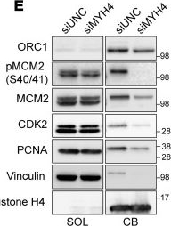 Fig.3.E showing Western Blotting from the publication: The class II myosin MYH4 safeguards genome integrity and suppresses tumor progression.