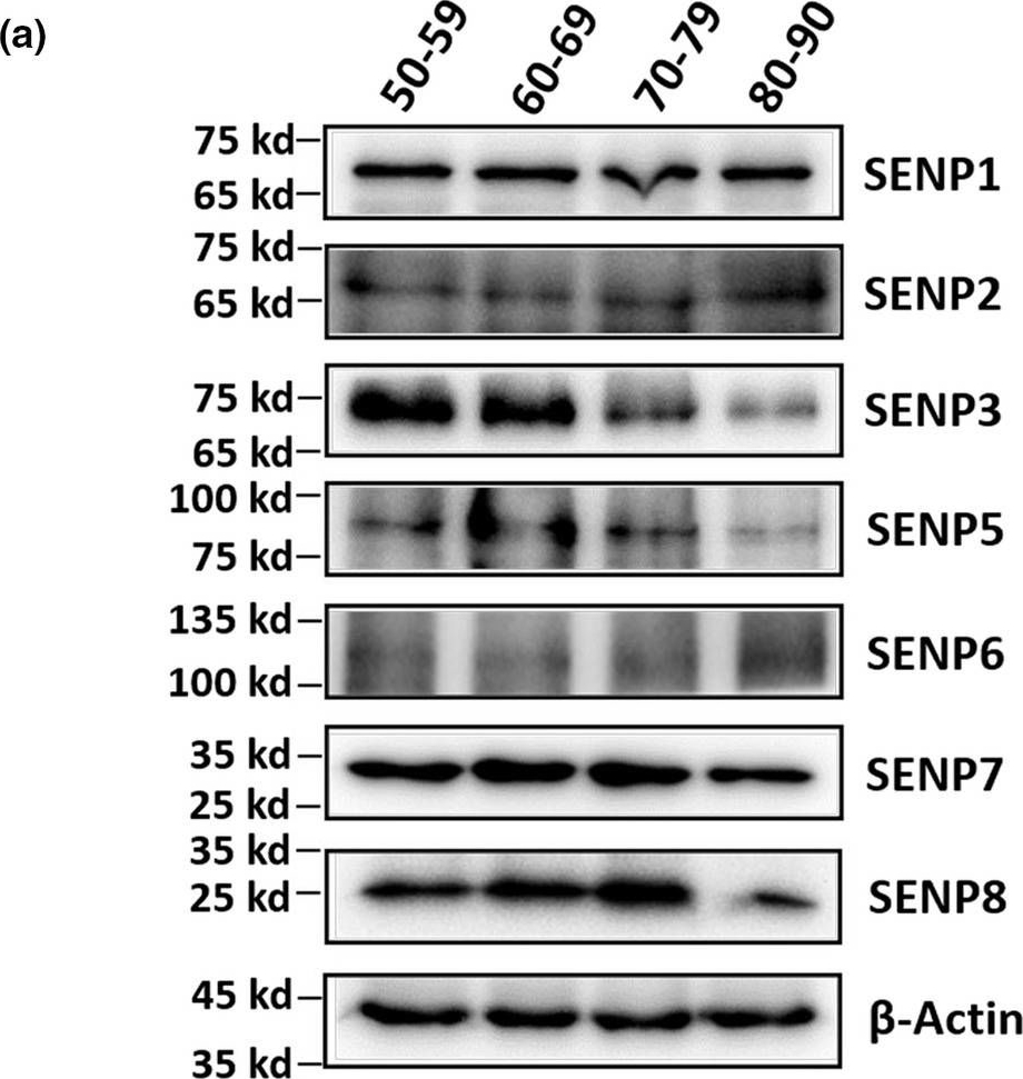 Fig.2.A showing Western Blotting in a Homo sapiens (Human) sample from the publication: Molecular signature for senile and complicated cataracts derived from analysis of sumoylation enzymes and their substrates in human cataract lenses.