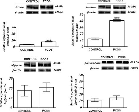 Fig.3.A showing Western Blotting in a Homo sapiens (Human) sample from the publication: Small leucine-rich proteoglycans (SLRPs) in the endometrium of polycystic ovary syndrome women: a pilot study.