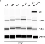 Fig.7.D showing Simple Western - Size in a Homo sapiens (Human) sample from the publication: Role of Annexin 7 (ANXA7) as a Tumor Suppressor and a Regulator of Drug Resistance in Thyroid Cancer.
