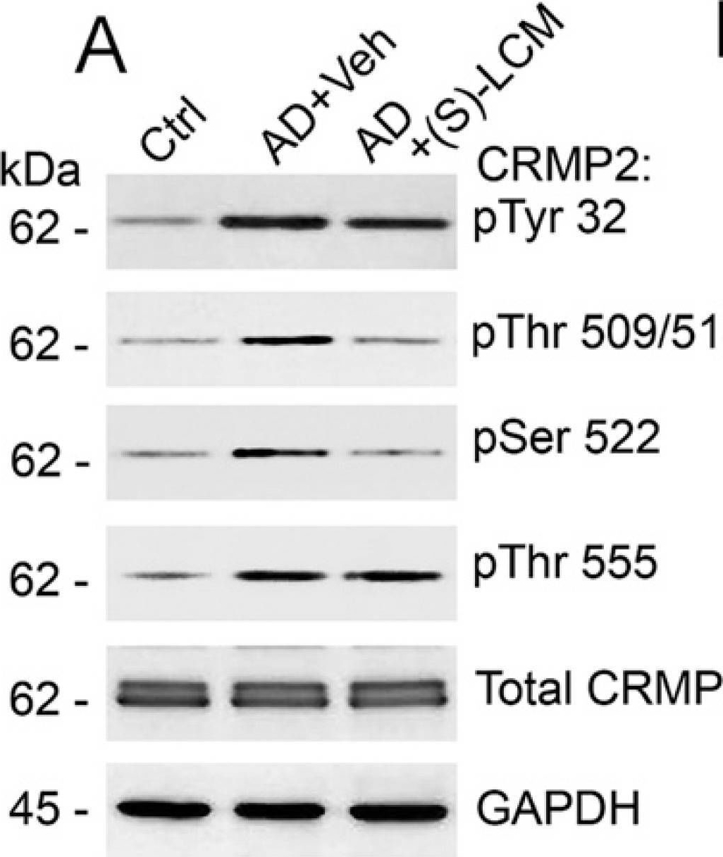 Fig.2.A showing Western Blotting in a Mus musculus (House mouse) sample from the publication: Collapsin Response Mediator Protein 2 (CRMP2) Modulates Mitochondrial Oxidative Metabolism in Knock-In AD Mouse Model.
