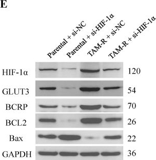 Fig.6.E showing Western Blotting in a Homo sapiens (Human) sample from the publication: The EGR1/caspase-14/HIF-1α axis mediates tamoxifen resistance in MCF-7 breast cancer cells.