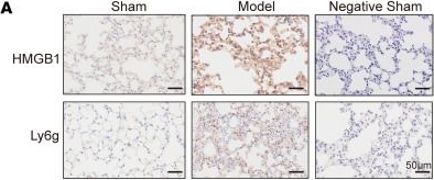 Fig.2.A showing Immunohistochemistry from the publication: HMGB1-mediated formation of IL-33-abundant NETs drives lung-to-kidney injury in severe pneumonia-associated acute kidney injury.