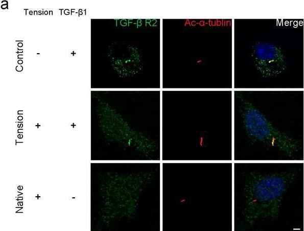 Fig.8.A showing Immunocytochemistry-immunofluorescence from the publication: Mechanical stimulation promotes enthesis injury repair by mobilizing Prrx1+ cells via ciliary TGF-β signaling.