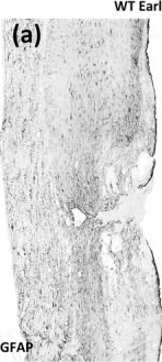 Fig.3.A showing Immunohistochemistry in a Mus musculus (House mouse) sample from the publication: Drebrin Upregulation Regulates Astrocyte Polarization and Supports Tissue Recovery After Spinal Cord Injury in Mice.