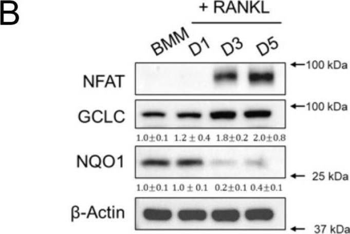 Fig.1.B showing Western Blotting from the publication: Divergent Requirements for Glutathione Biosynthesis During Osteoclast Differentiation In Vitro and In Vivo.