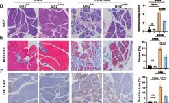 たかページ COL1A1 Antibody (E8I9Z) | Cell Signaling Technology